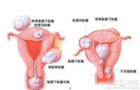 吃瓜导致阴囊肿,揭秘日常饮食中的健康隐患